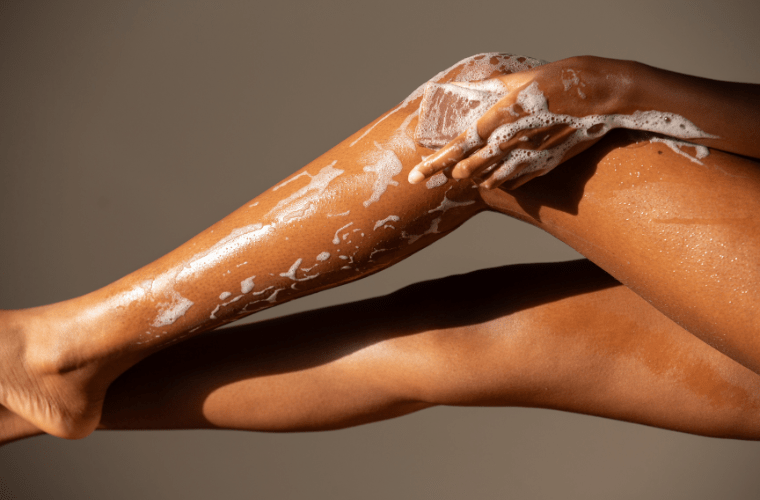 How to Combat Keratosis Pilaris Naturally: Tips for Smooth Skin